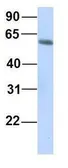 Anti-GTPBP2 antibody, N-term used in Western Blot (WB). GTX46998