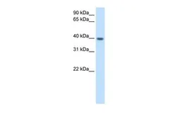 Anti-ITGB1BP2 antibody, N-term used in Western Blot (WB). GTX47041