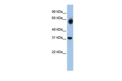 Anti-DHRS2 antibody, Internal used in Western Blot (WB). GTX47054