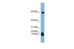 Anti-STATH antibody, Internal used in Western Blot (WB). GTX47081