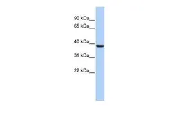 Anti-ALAD antibody, N-term used in Western Blot (WB). GTX47130