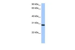 Anti-RALYL antibody, C-term used in Western Blot (WB). GTX47193