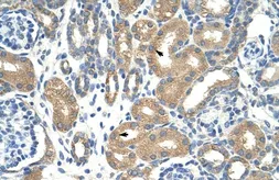 Anti-APOBEC3D antibody, N-term used in IHC (Paraffin sections) (IHC-P). GTX47206
