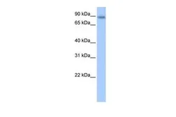 Anti-JAKMIP1 antibody, Internal used in Western Blot (WB). GTX47214