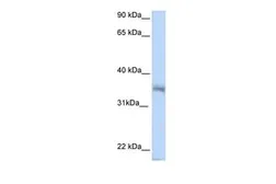 Anti-HEXIM2 antibody, N-term used in Western Blot (WB). GTX47216