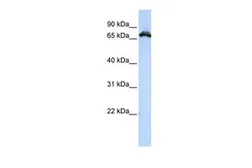 Anti-RAVER1 antibody, Internal used in Western Blot (WB). GTX47225
