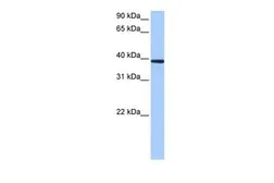 Anti-MRM1 antibody, C-term used in Western Blot (WB). GTX47251