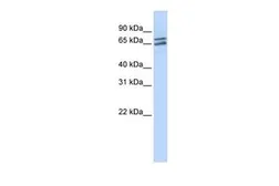Anti-PAPOLG antibody, Internal used in Western Blot (WB). GTX47259