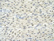 Anti-DAZAP1 antibody, Internal used in IHC (Paraffin sections) (IHC-P). GTX47275