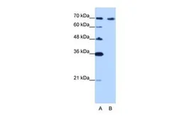 Anti-CDKN2AIP antibody, C-term used in Western Blot (WB). GTX47294
