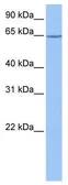 Anti-NOL5A antibody, Internal used in Western Blot (WB). GTX47347