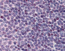 Anti-PCBP1 antibody, Internal used in IHC (Paraffin sections) (IHC-P). GTX47349