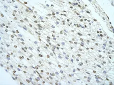 Anti-KHSRP antibody, Internal used in IHC (Paraffin sections) (IHC-P). GTX47379