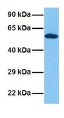 Anti-GRSF1 antibody, Internal used in Western Blot (WB). GTX47396