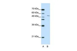 Anti-GRSF1 antibody, N-term used in Western Blot (WB). GTX47397