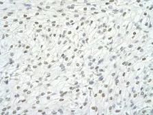 Anti-RBM9 antibody, Internal used in IHC (Paraffin sections) (IHC-P). GTX47400
