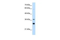 Anti-RPLP0 antibody, Internal used in Western Blot (WB). GTX47426