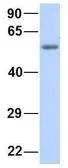 Anti-KCNV1 antibody, N-term used in Western Blot (WB). GTX47444