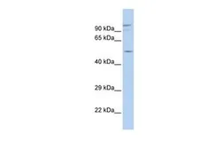 Anti-GJA3 antibody, N-term used in Western Blot (WB). GTX47482