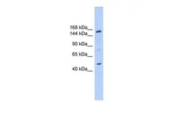 Anti-SHPRH antibody, N-term used in Western Blot (WB). GTX47490