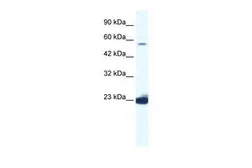Anti-DDX55 antibody, C-term used in Western Blot (WB). GTX47503