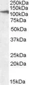 Anti-CLEC16A (aa1040-53) antibody, C-term used in Western Blot (WB). GTX47546
