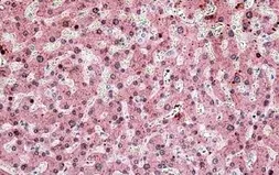Anti-ITIH4 antibody, Internal used in IHC (Paraffin sections) (IHC-P). GTX47566