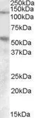 Anti-Palladin (aa895-907) antibody, Internal used in Western Blot (WB). GTX47571