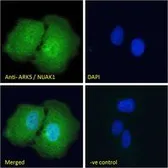 Anti-ARK5 antibody, Internal used in Immunocytochemistry/ Immunofluorescence (ICC/IF). GTX47589