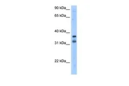 Anti-KCNRG antibody, N-term used in Western Blot (WB). GTX47611