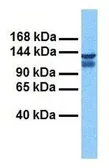 Anti-CLCN3 antibody, C-term used in Western Blot (WB). GTX47617