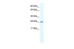 Anti-CLIC5 antibody, C-term used in Western Blot (WB). GTX47672