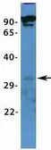 Anti-VDAC3 antibody, N-term used in Western Blot (WB). GTX47682