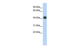 Anti-CACNB3 antibody, N-term used in Western Blot (WB). GTX47704