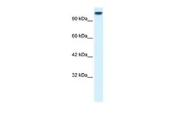 Anti-KIF3C antibody, Internal used in Western Blot (WB). GTX47735