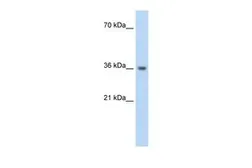 Anti-PHYHIP antibody, N-term used in Western Blot (WB). GTX47736