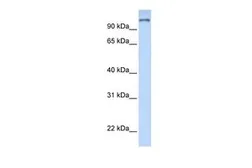 Anti-PARP9 antibody, N-term used in Western Blot (WB). GTX47754