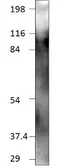 Anti-TMEM16A antibody used in Western Blot (WB). GTX47816