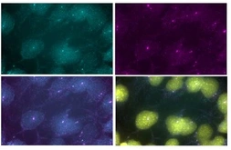 Anti-Usher antibody (C-terminal) used in Immunocytochemistry/ Immunofluorescence (ICC/IF). GTX47843