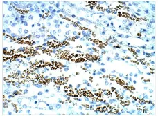 Anti-STRA6 antibody used in IHC (Paraffin sections) (IHC-P). GTX47858