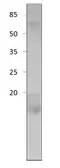 Anti-Cornichon antibody used in Western Blot (WB). GTX47903