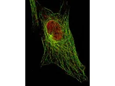 Anti-STAT5A (phospho Tyr694) antibody [5F6.F1] used in Immunocytochemistry/ Immunofluorescence (ICC/IF). GTX48647