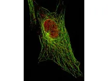 Anti-STAT5A (phospho Tyr694) antibody [5F6.F1] used in Immunocytochemistry/ Immunofluorescence (ICC/IF). GTX48648