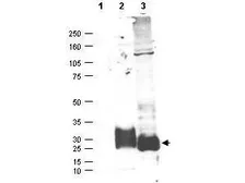 Anti-MFAP5 antibody used in Western Blot (WB). GTX48656