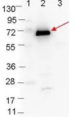 Anti-Borrelia burgdorferi Osp C antibody used in Western Blot (WB). GTX48806