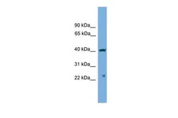 Anti-Centromere protein N antibody, Internal used in Western Blot (WB). GTX48921