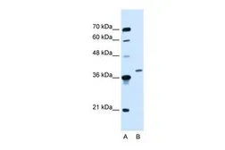 Anti-HOXD11 antibody, Internal used in Western Blot (WB). GTX48946
