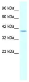 Anti-HMX1 antibody, Internal used in Western Blot (WB). GTX48949