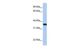 Anti-HOXD1 antibody, C-term used in Western Blot (WB). GTX48951