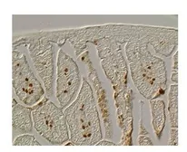 Anti-FOXF1 antibody, Internal used in IHC (Paraffin sections) (IHC-P). GTX48981